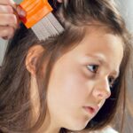 Can hair dye kill lice