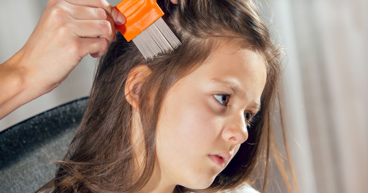 Can hair dye kill lice